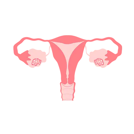 Ovarian stimulation treatments can help with female infertility. Contact NCCRM today to get started with your fertility treatment program.